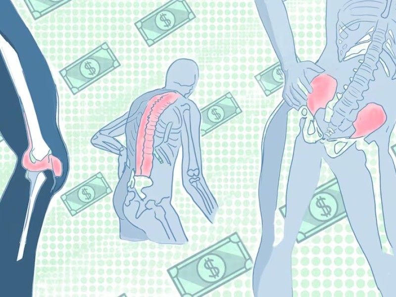 Illustration of bodies with visible skeletons and images of dollars in the background